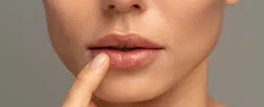 Ácido hialurónico para labios