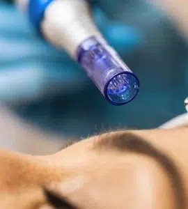 Exosomas en Medicina Regenerativa