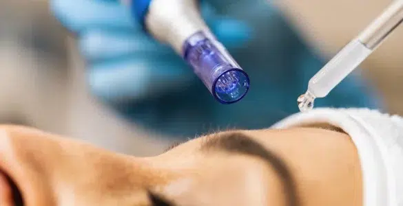 Exosomas en Medicina Regenerativa