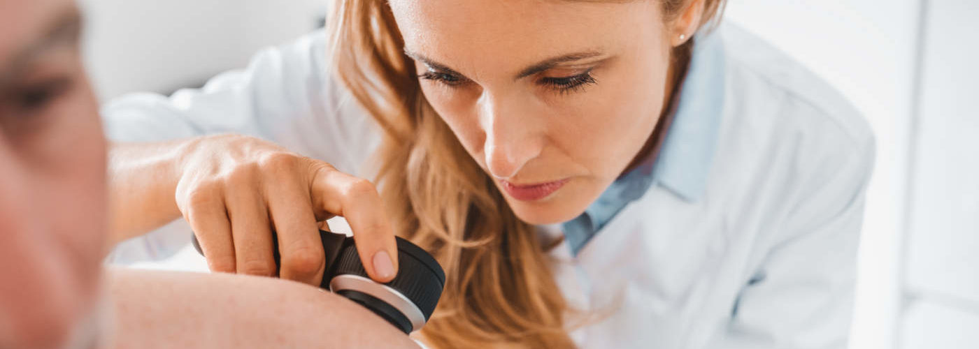 queratosis seborreica o melanoma: como distinguirlos