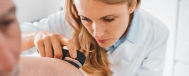 queratosis seborreica o melanoma: como distinguirlos