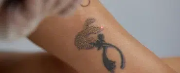 Cómo eliminar un tatuaje de forma segura