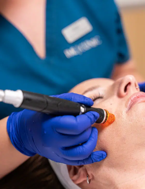 Hydrafacial, primer paso para una piel luminosa