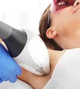 Depilación Láser en axilas con Vectus