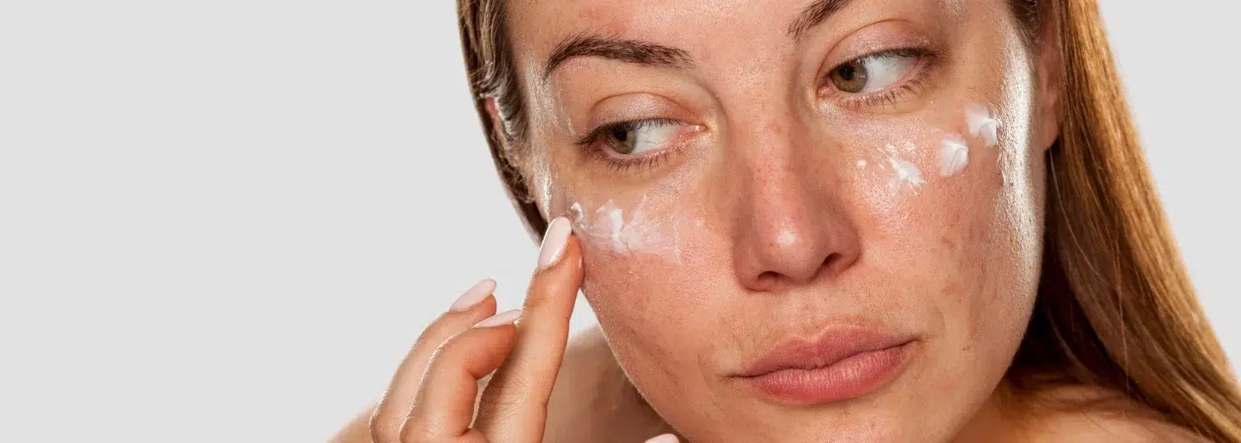 manchas las nuevas arrugas