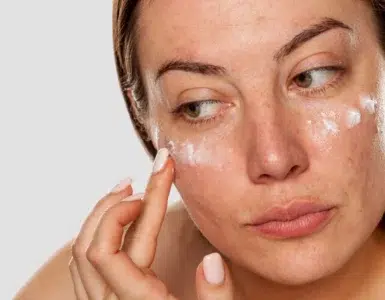 manchas las nuevas arrugas