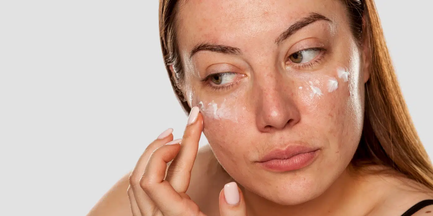 OPINIÓN | Manchas: el nuevo biomarcador de la edad cutánea