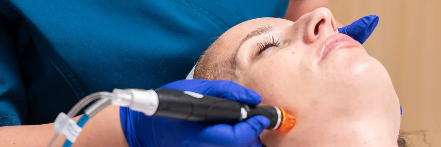 Hydrafacial: Tratamiento pre boda para novias e invitadas