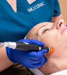Hydrafacial: Tratamiento pre boda para novias e invitadas