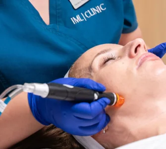 Hydrafacial: Tratamiento pre boda para novias e invitadas