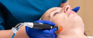 Hydrafacial: Tratamiento pre boda para novias e invitadas