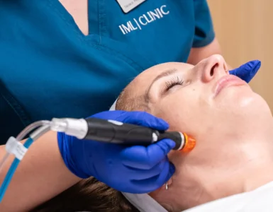 Hydrafacial: Tratamiento pre boda para novias e invitadas