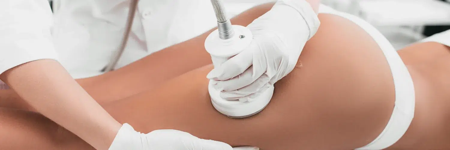 Tratamiento HIFU corporal en IML Clinic Madrid