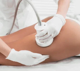 Tratamiento HIFU corporal en IML Clinic Madrid