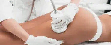 Tratamiento HIFU corporal en IML Clinic Madrid
