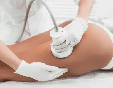 Tratamiento HIFU corporal en IML Clinic Madrid