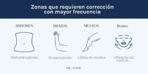 zonas de mayor flacidez