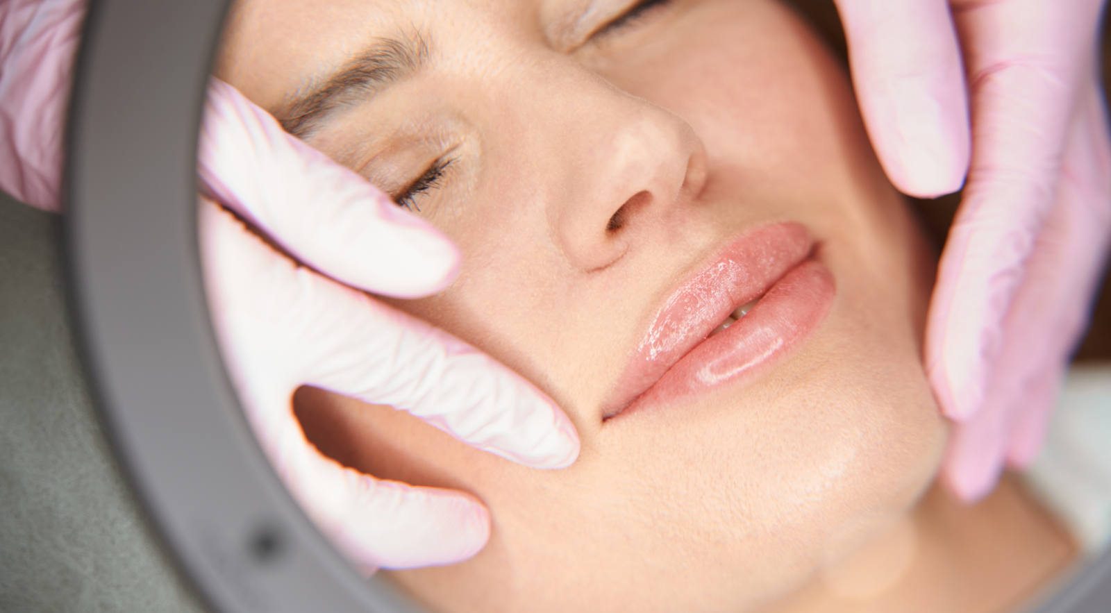 ¿Qué tratamientos existen para mejorar la estética de los labios?