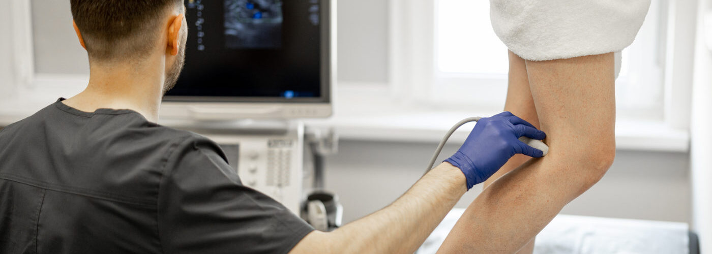 Varices: 8 mitos que debes dejar de creer