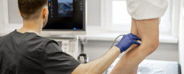 Varices: 8 mitos que debes dejar de creer